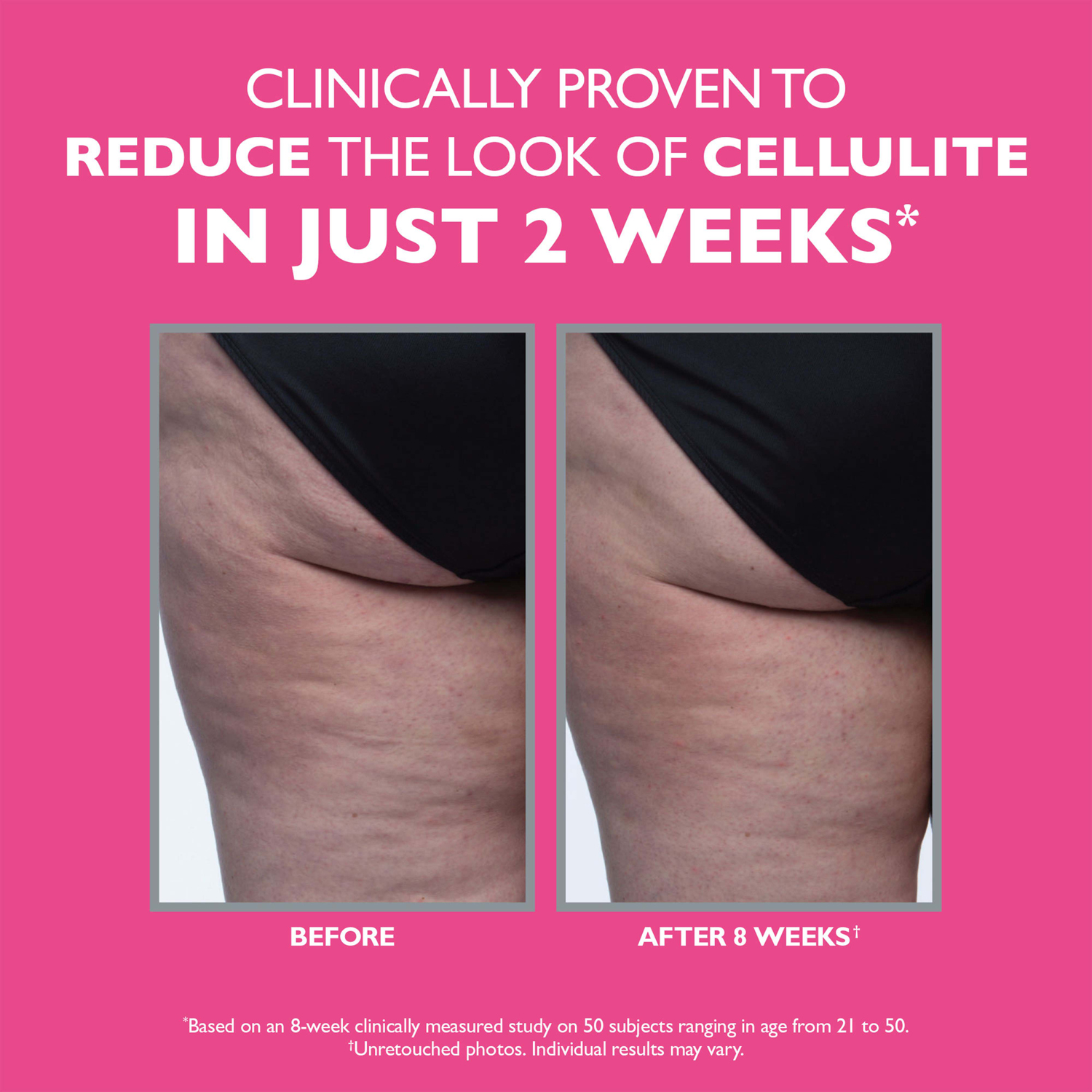 Firmx® Tight & Toned Cellulite Treatment