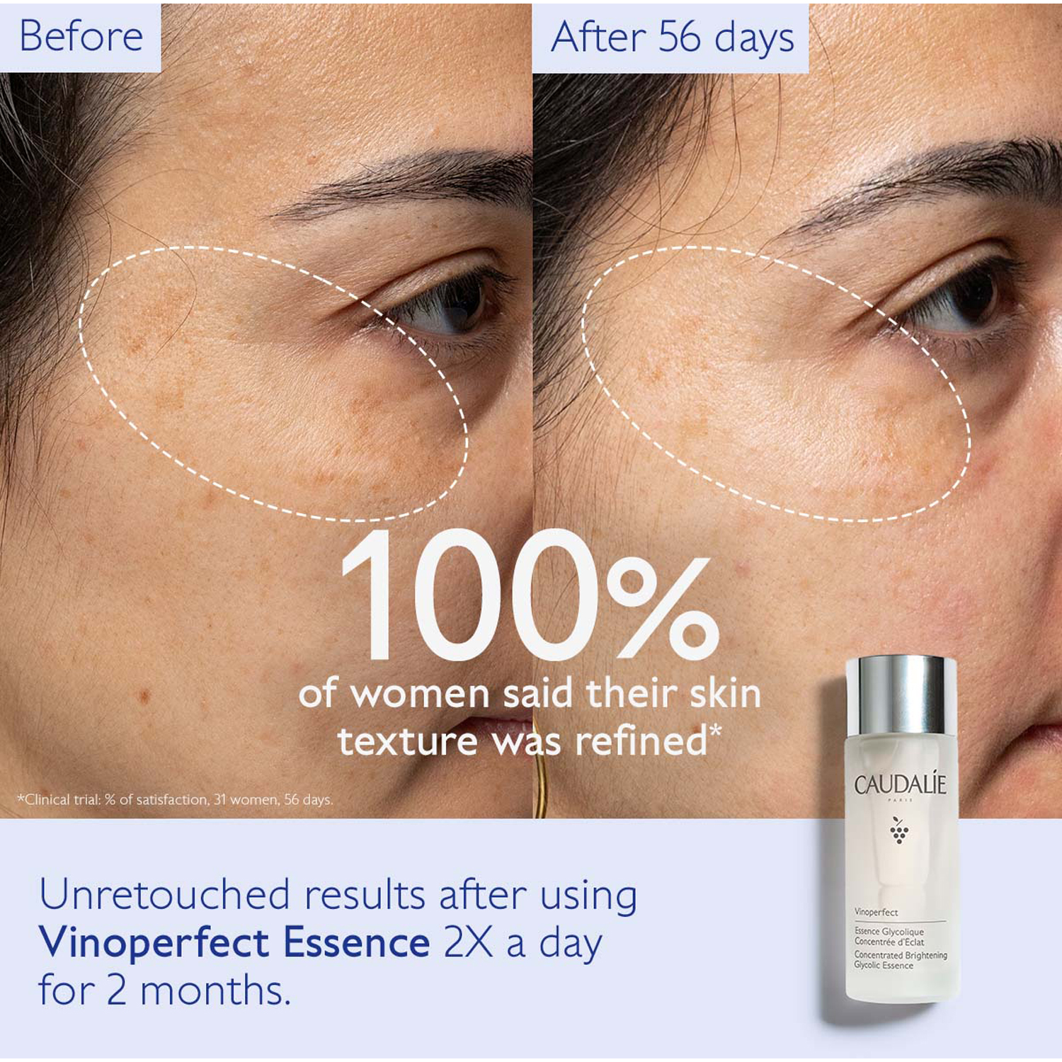 Vinoperfect Concentrated Glycolic Essence