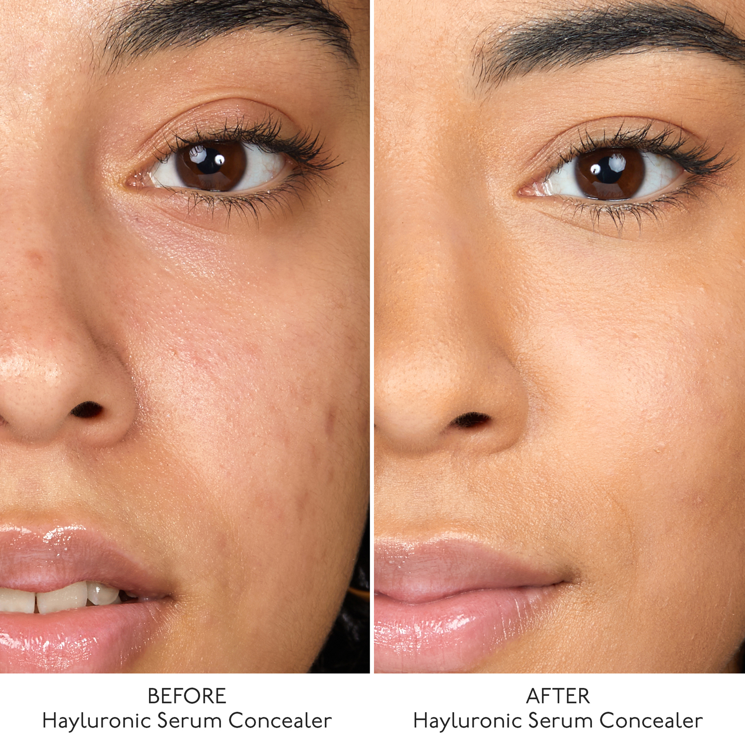 Hyaluronic Serum Concealer