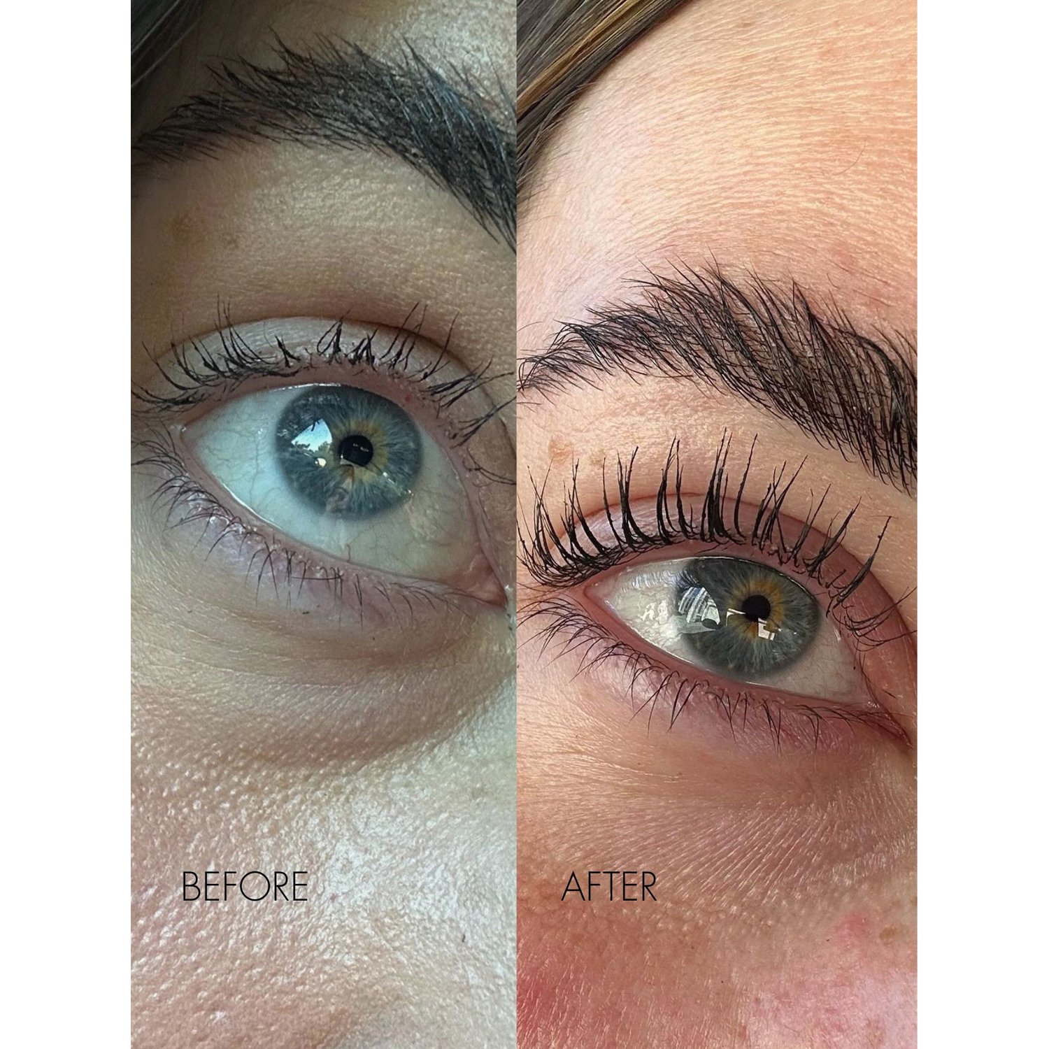 Eyelash Growth Serum