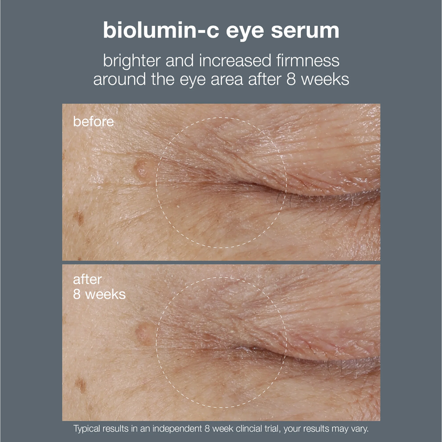 BioLumin-C Eye Serum